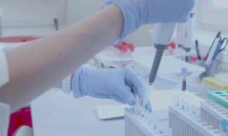 Teresina chega a 50 mortes por Covid-19, diz boletim da Sesapi