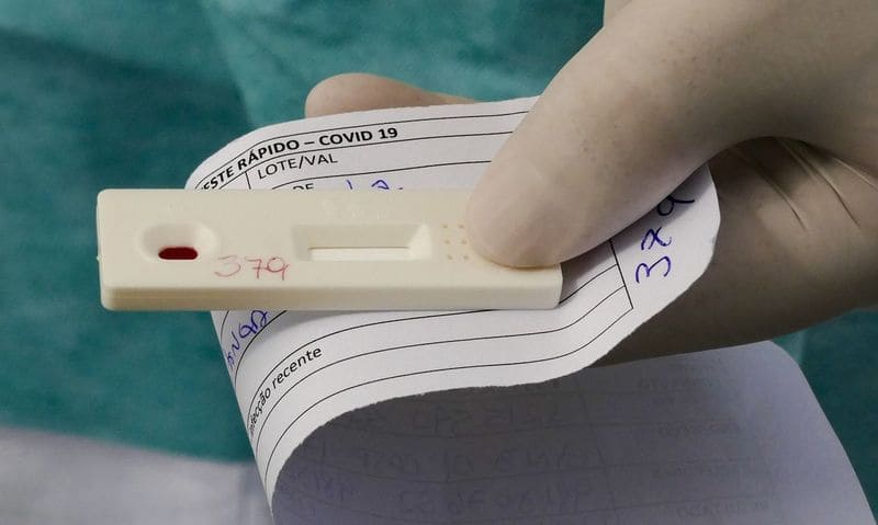 Piauí tem 1.065 mortes e 37 mil casos de novo coronavírus