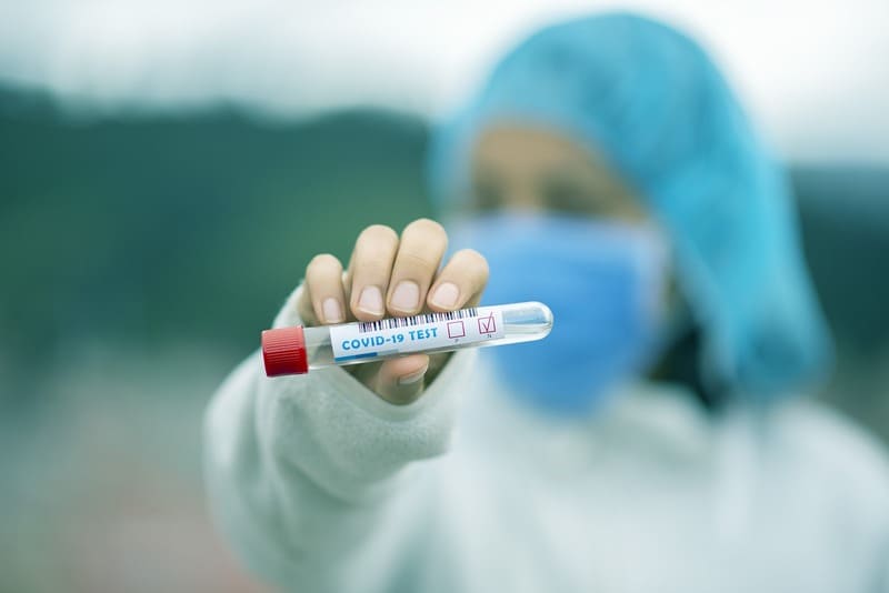 Piauí registra 1,2 mil casos de Covid em 24 horas; total é de 23 mil