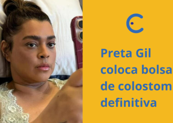 Cantora Preta Gil coloca bolsa de colostomia definitiva